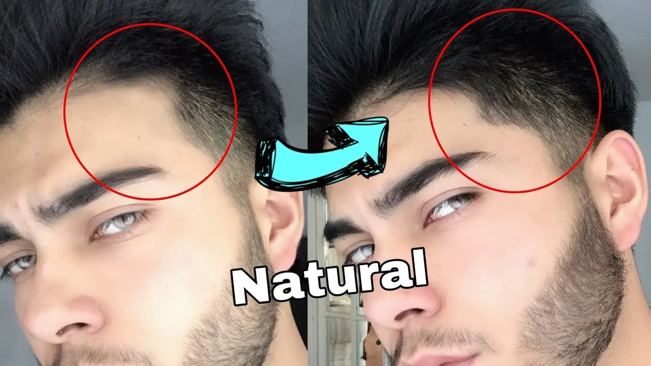 como hacer crecer el pelo de la frente - Cómo recuperar el cabello de la parte frontal