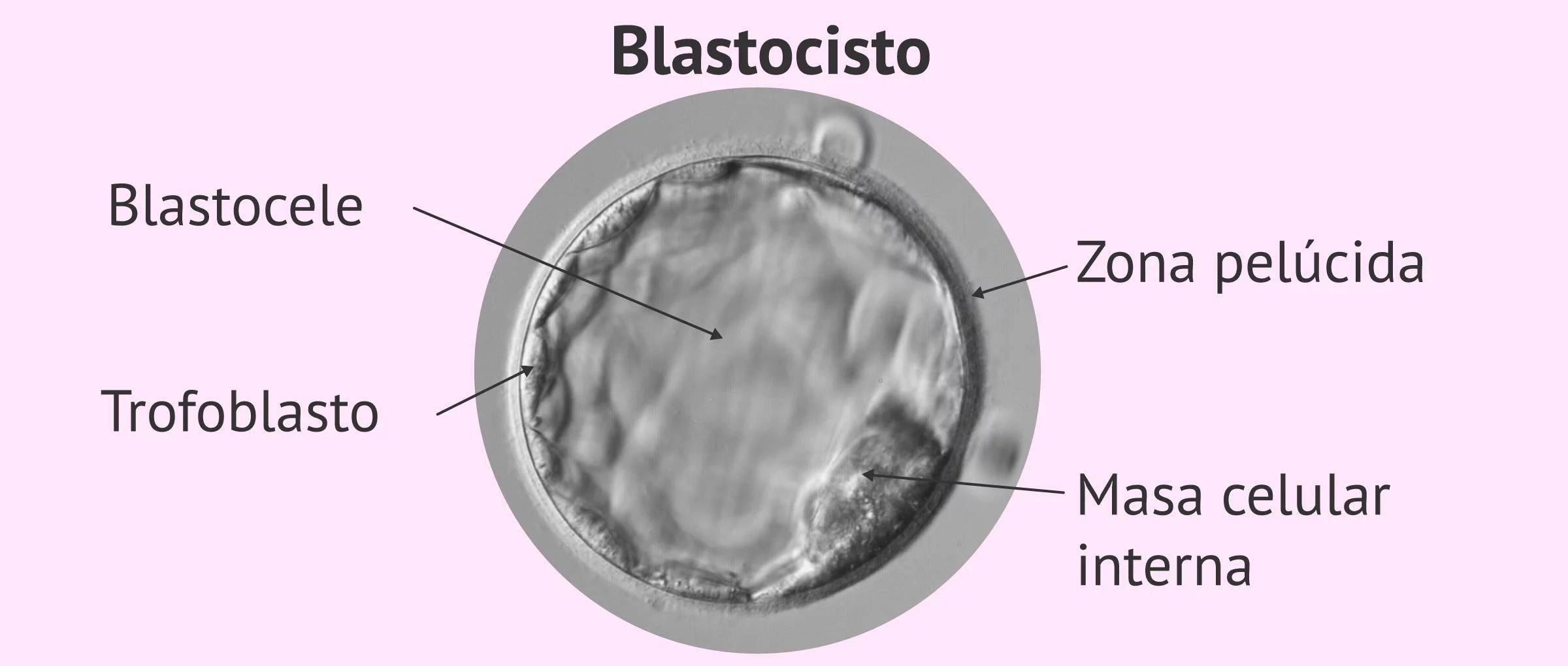 blastocisto pelucida masizo y trofoblasto - Cómo se clasifican los blastocistos