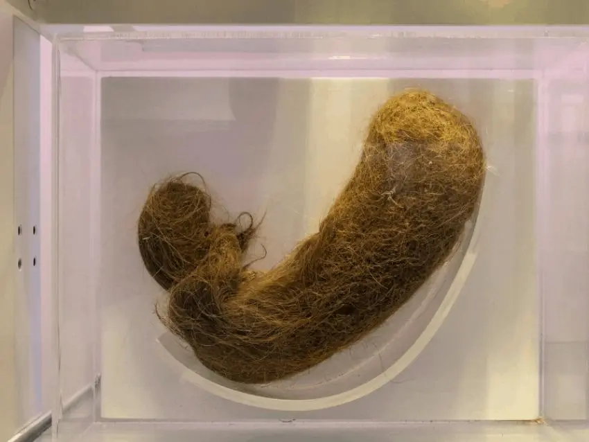 bolas de pelo en el intestino - Cómo se llama los pelos del intestino