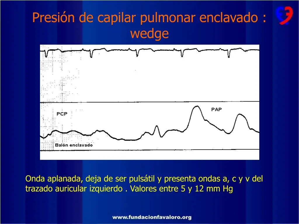 capilar enclavamiento wedge - Cuál es la presión Telediastolica del ventriculo izquierdo