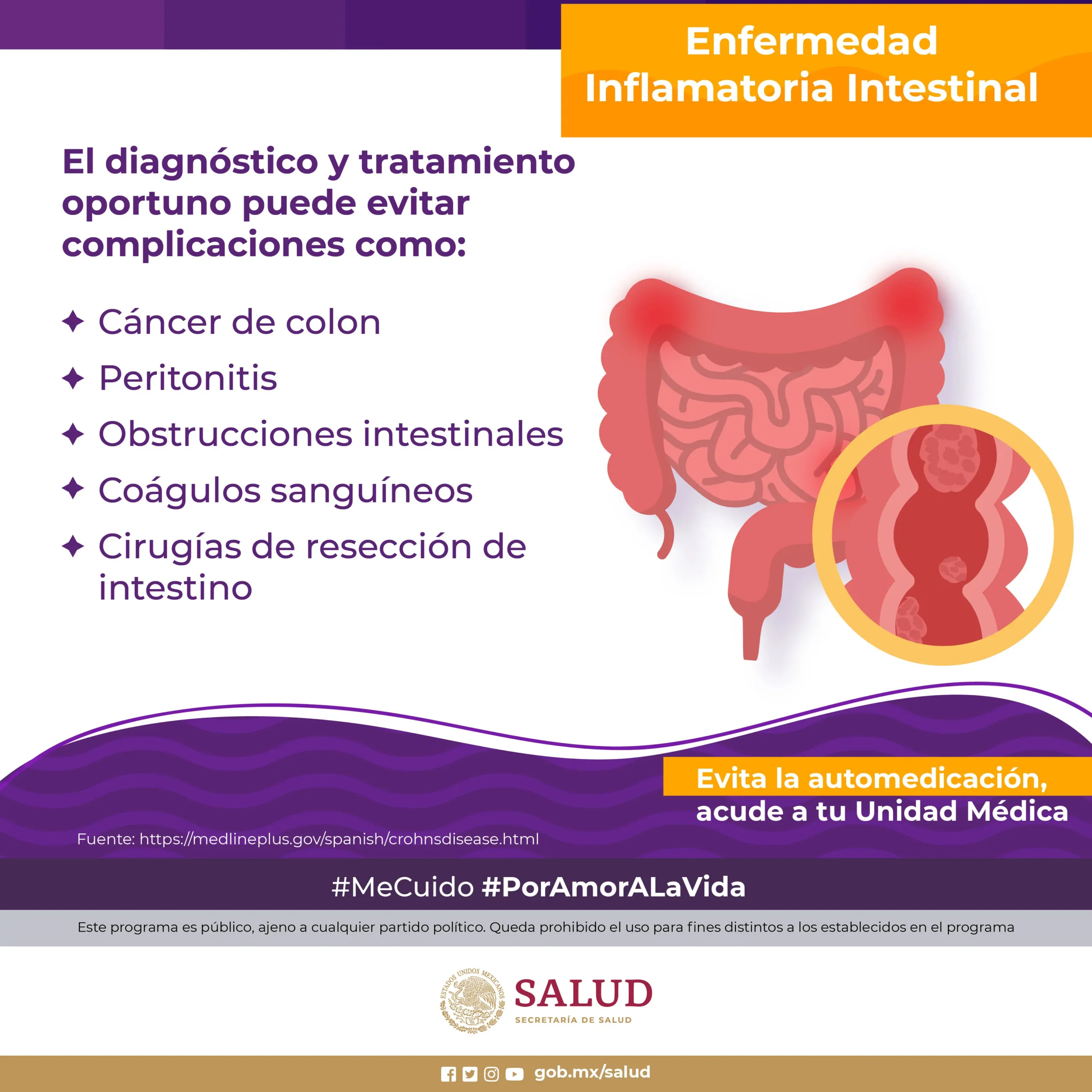 inflamacion de capilar intestinal - Cuáles son los síntomas de los intestinos inflamados