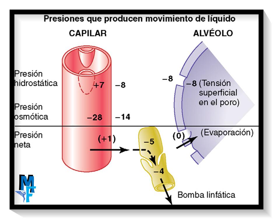 aumento de presion capilar pulmonar - Cuándo aumenta la presión pulmonar