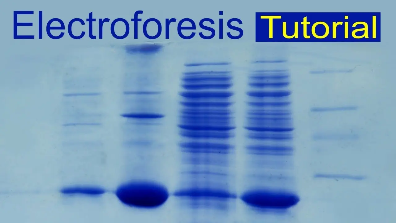 electroforesis capilar de proteinas para que sirve - Cuándo se pide la electroforesis