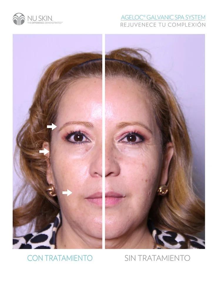 nuskin pelo antes y despues - Cuántas veces se puede usar la galvanica corporal