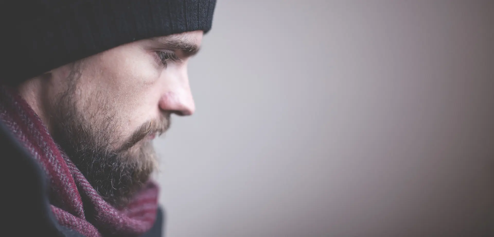 caida de pelo en la barba - Por que pierdes caída del pelo de la barba