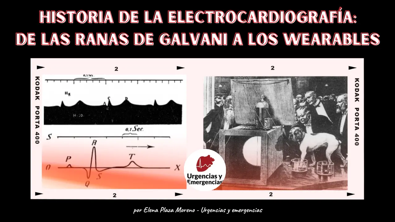 electrometro capilar de thomas - Por qué se le llama onda P