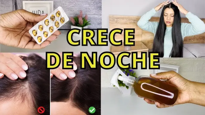 anticonceptivos para el crecimiento del pelo - Qué anticonceptivo es bueno para el cabello