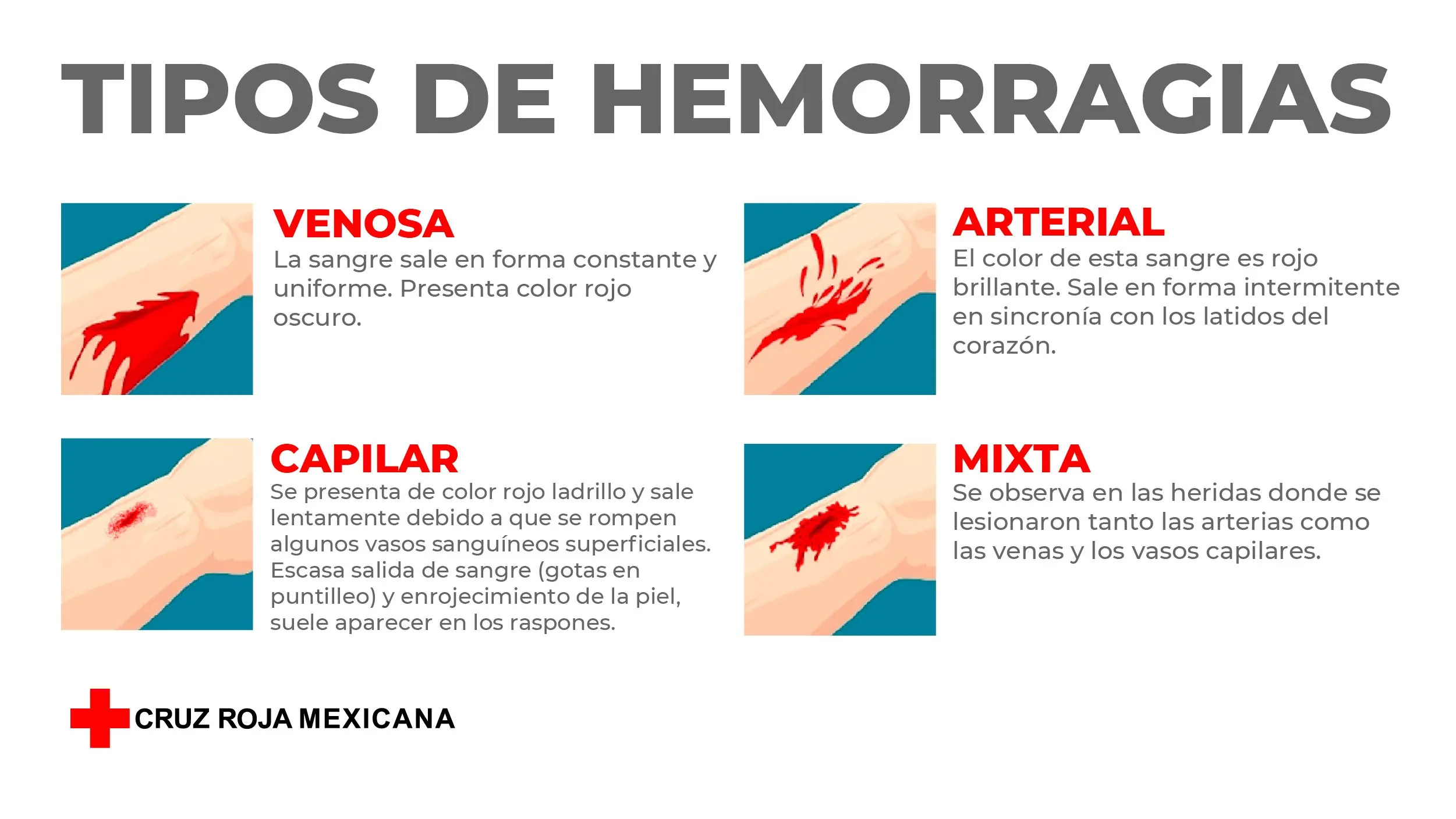 arterial venosa capilar - Qué es la arteria venosa