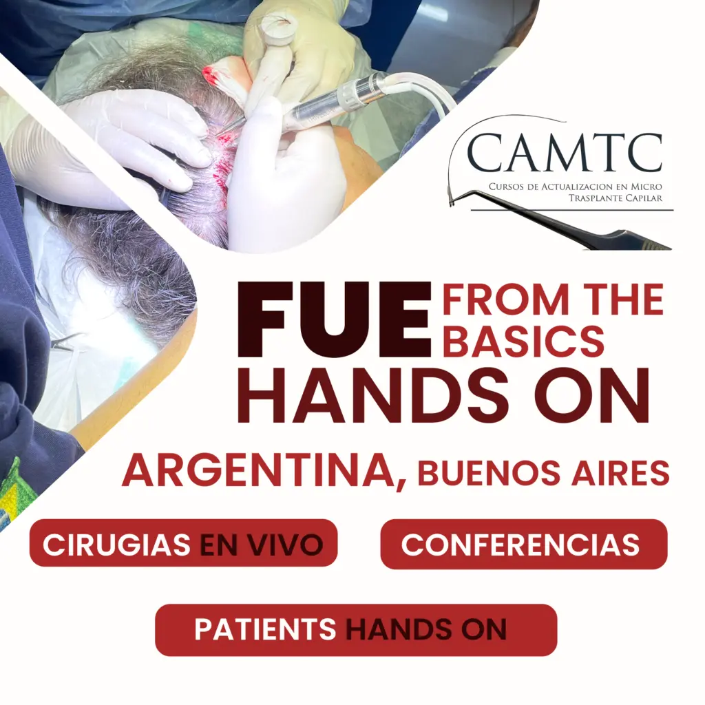 curso de implante capilar argentina - Que estudiar para injerto capilar