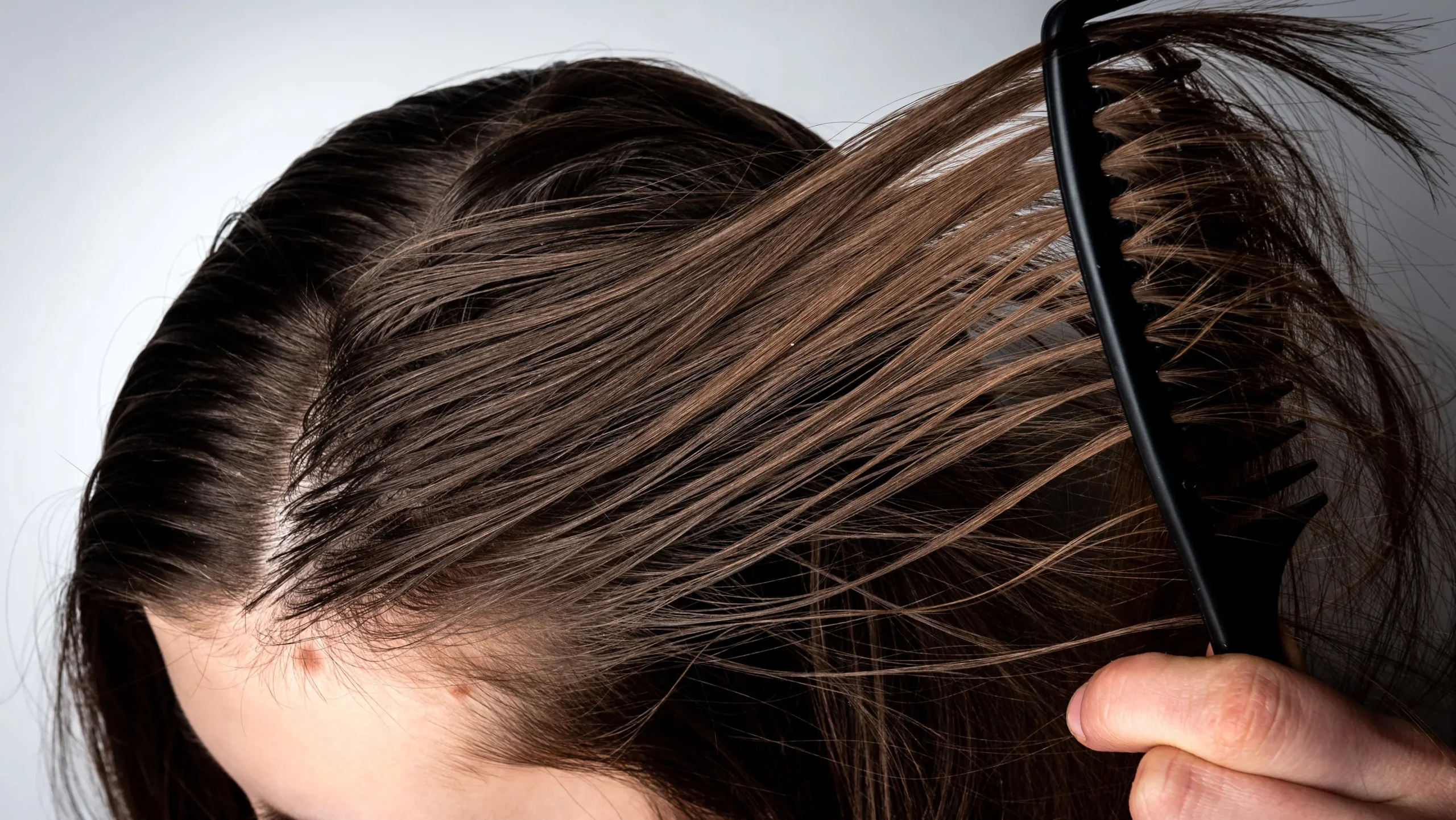 como quitar el pelo graso en mujeres - Qué hacer para quitar la grasa del cabello