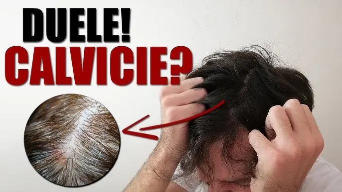 me duele la cabeza cuando me toco el pelo - Qué pasa cuando duele el cuero cabelludo de la cabeza