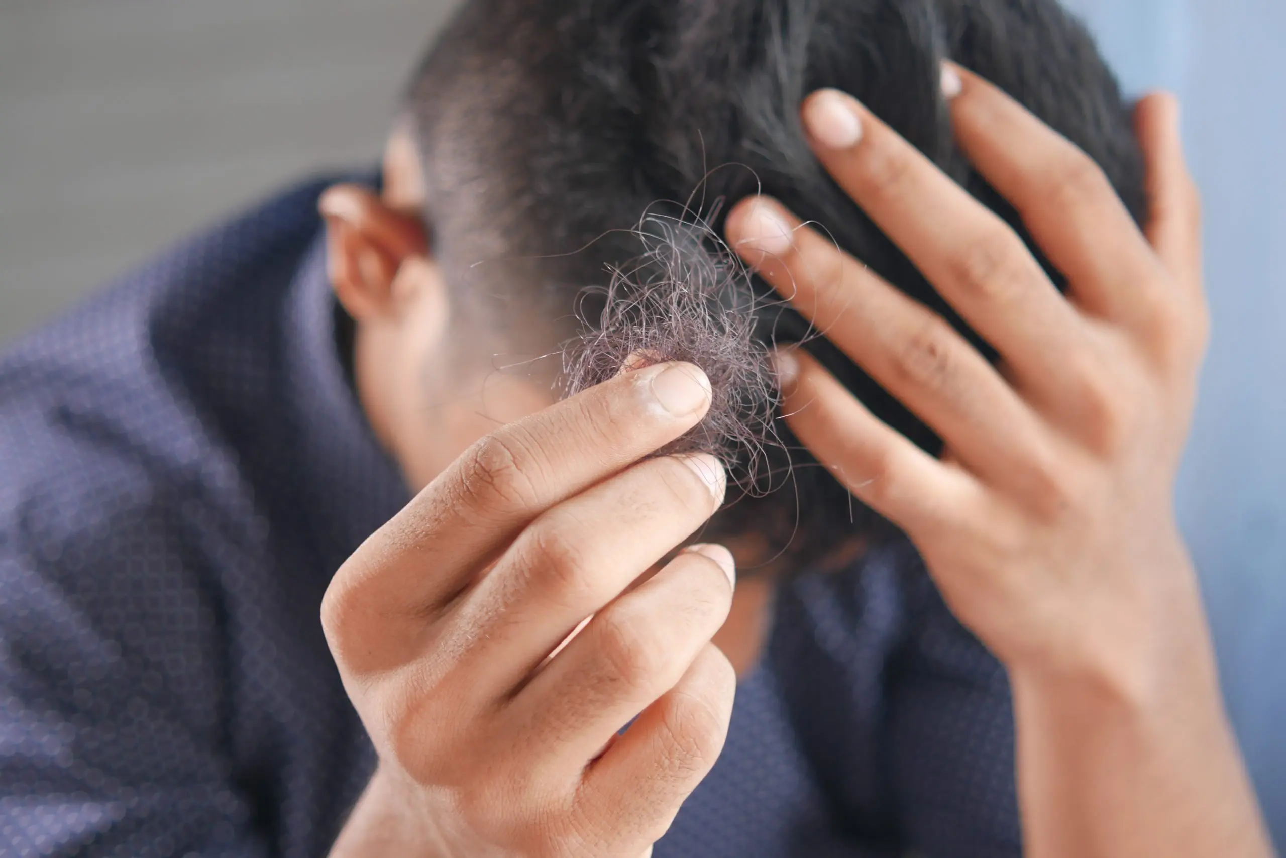 porque los bebes se estiran el pelo - Qué pasa cuando un niño se jala el cabello