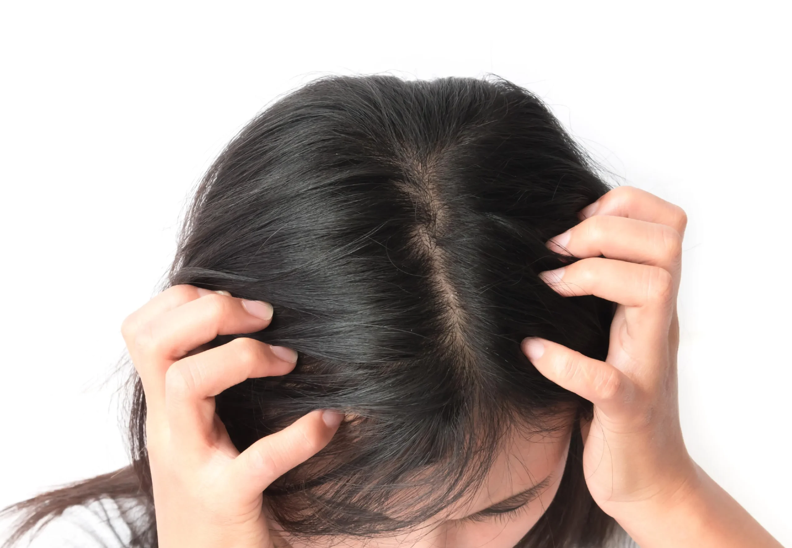 mechon blanco en el pelo - Qué pasa si tengo algo blanco en el pelo