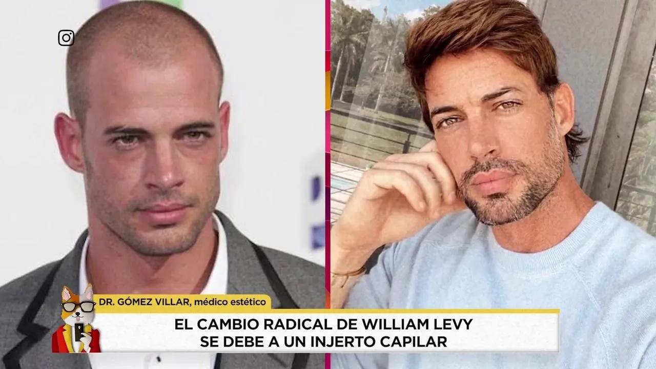 william levy se hizo tratamiento capilar - Que se operó William Levy