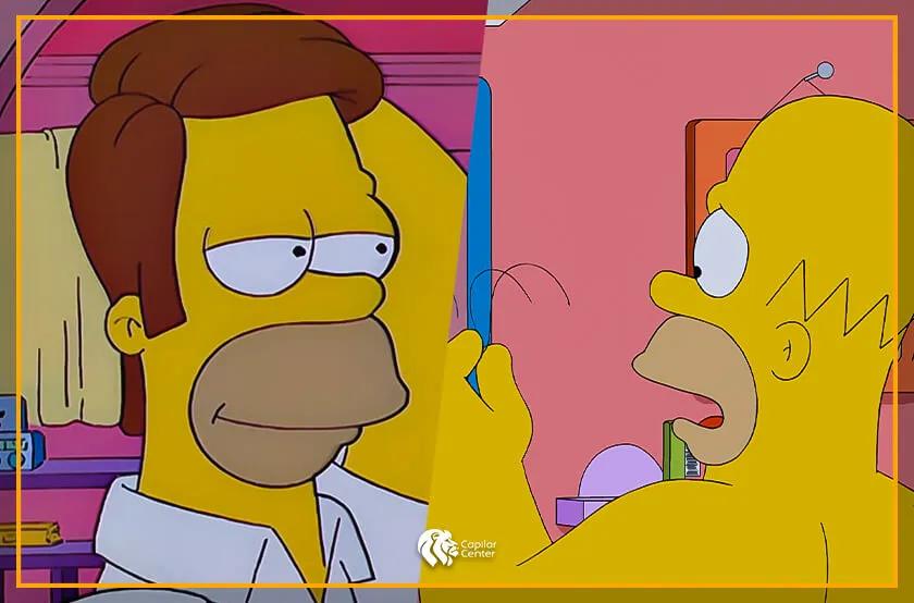 los simpsons trasplante capilar - Quién está casi calvo de Los Simpson