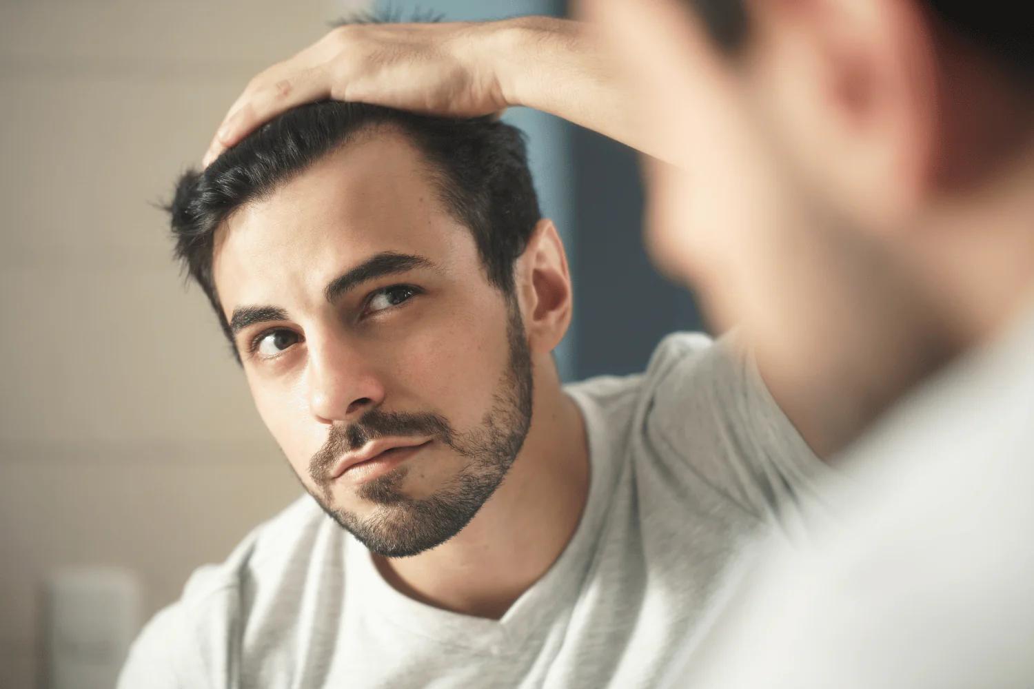 cortes de pelo para hombres con pico de viuda - Un corte de pelo queda bien con un pico de viuda